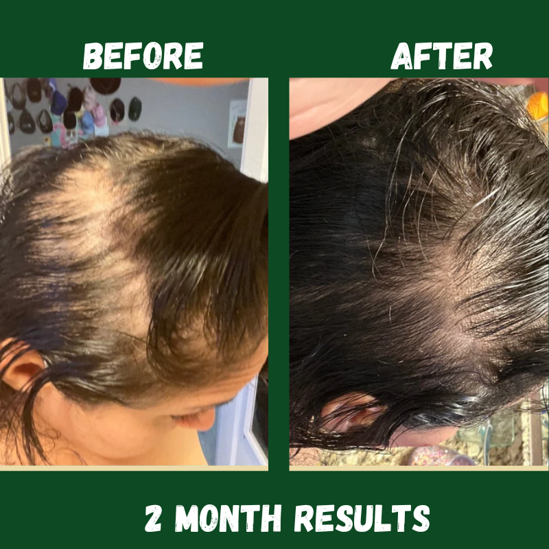 Natrivity Batana Oil Shampoo